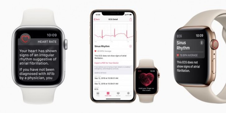 Apple watch series store 4 cardiogram