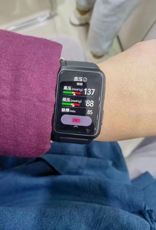 Huawei smartwatch with blood pressure monitoring to launch in 2021 -  Wareable