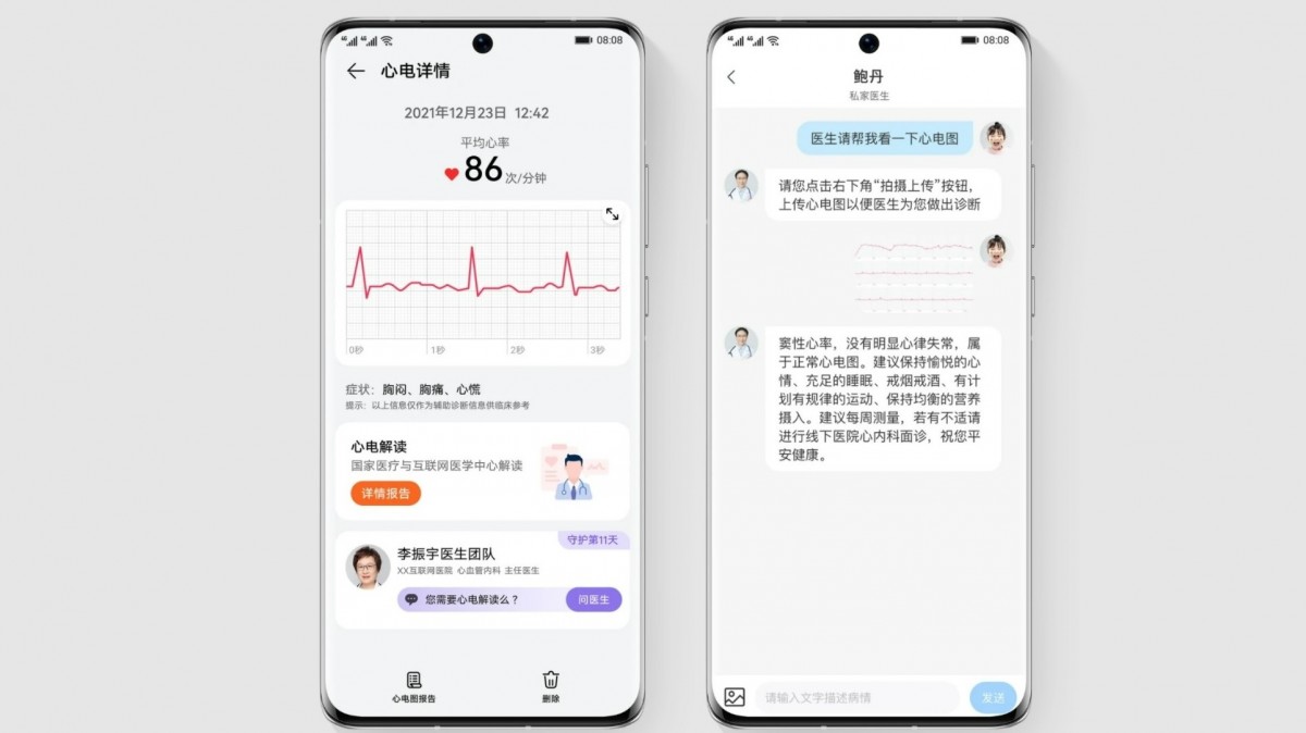 Huawei Watch D annoncé avec ECG et surveillance de la pression artérielle