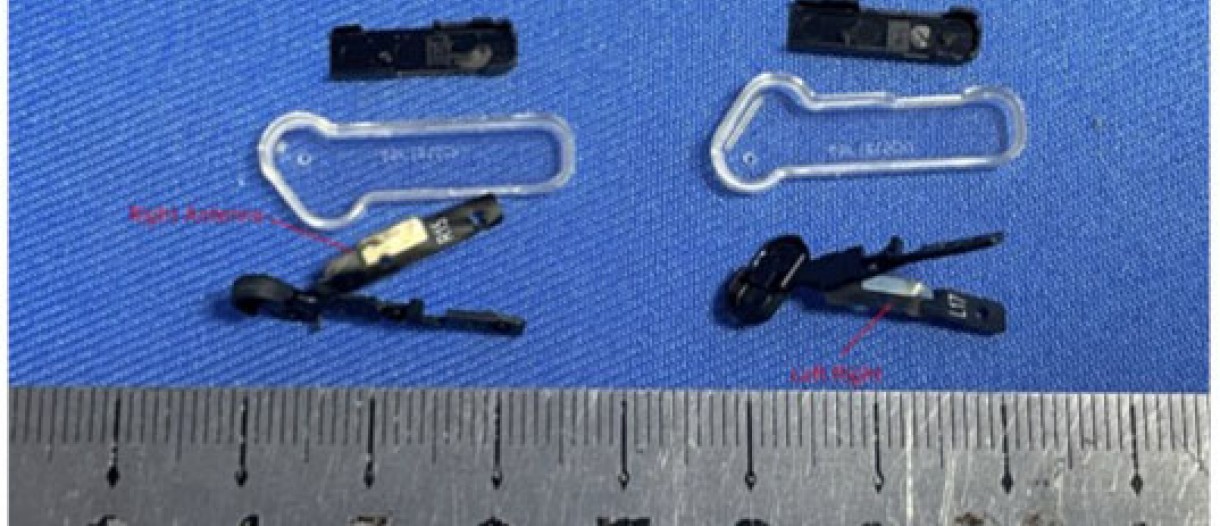 【新品・未開封】Noting ear stick Nothing Ear (stick)開封してみた - YouTube