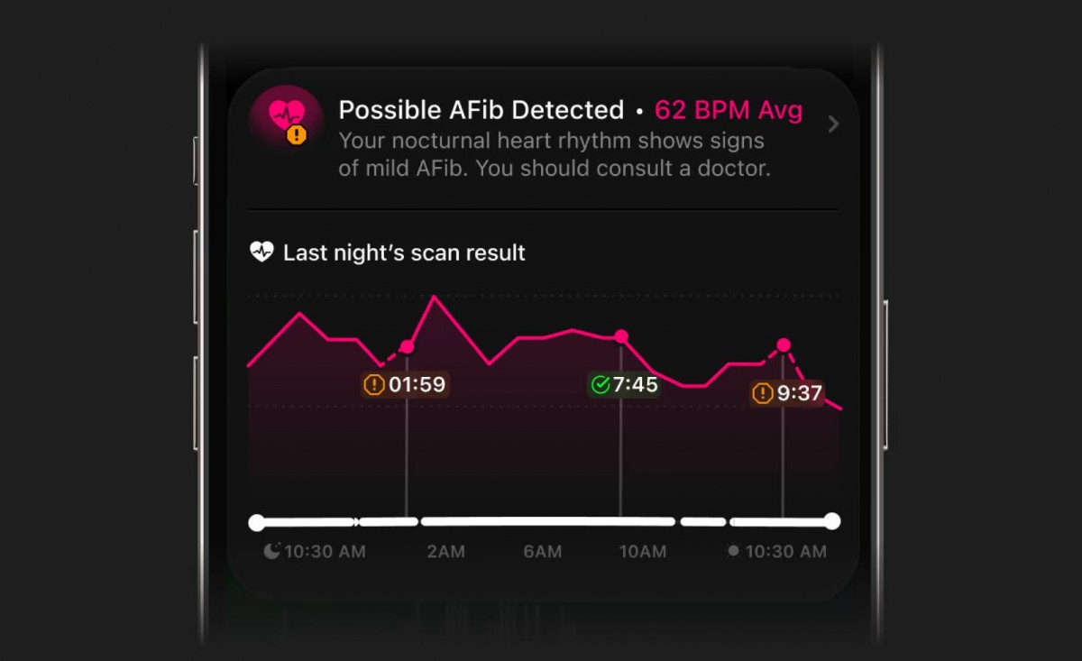 Optional AFib detection